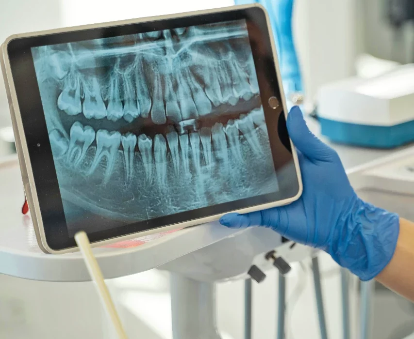 Рентгеновский снимок зубов в стоматологической клинике